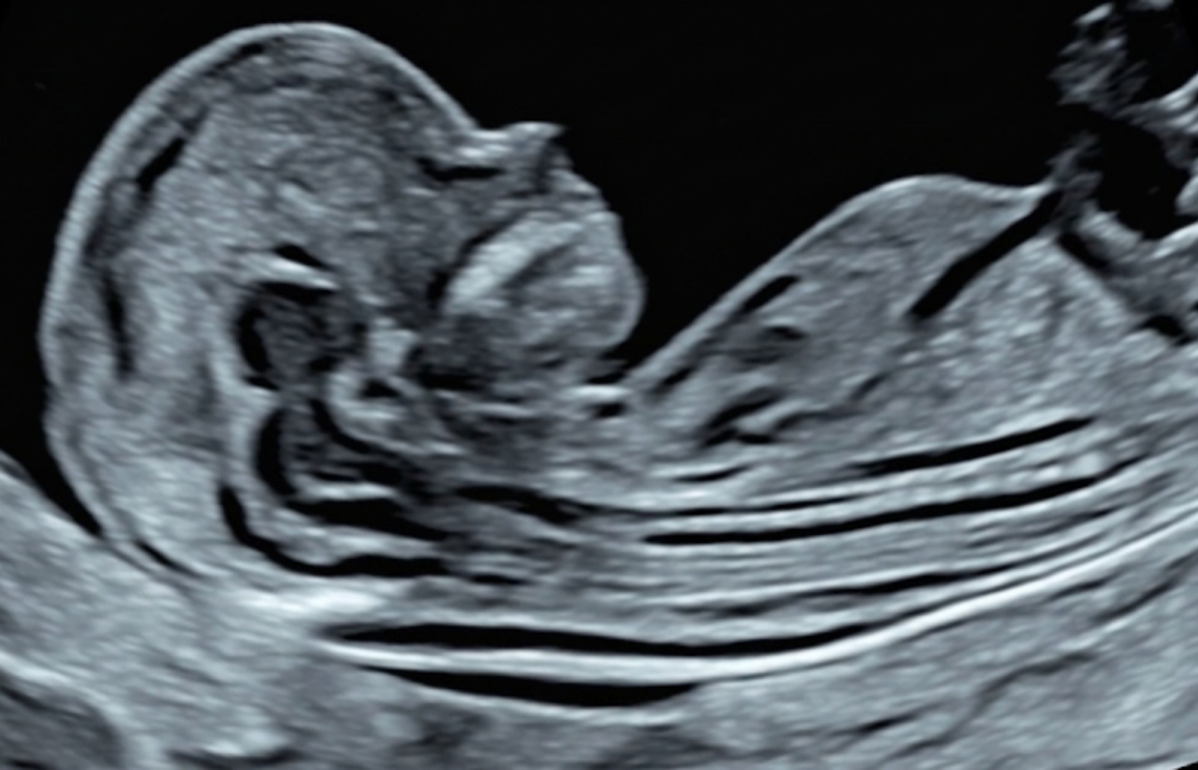 Online Fellowship Course in Basic and Advanced Fetal Ultrasound - B2